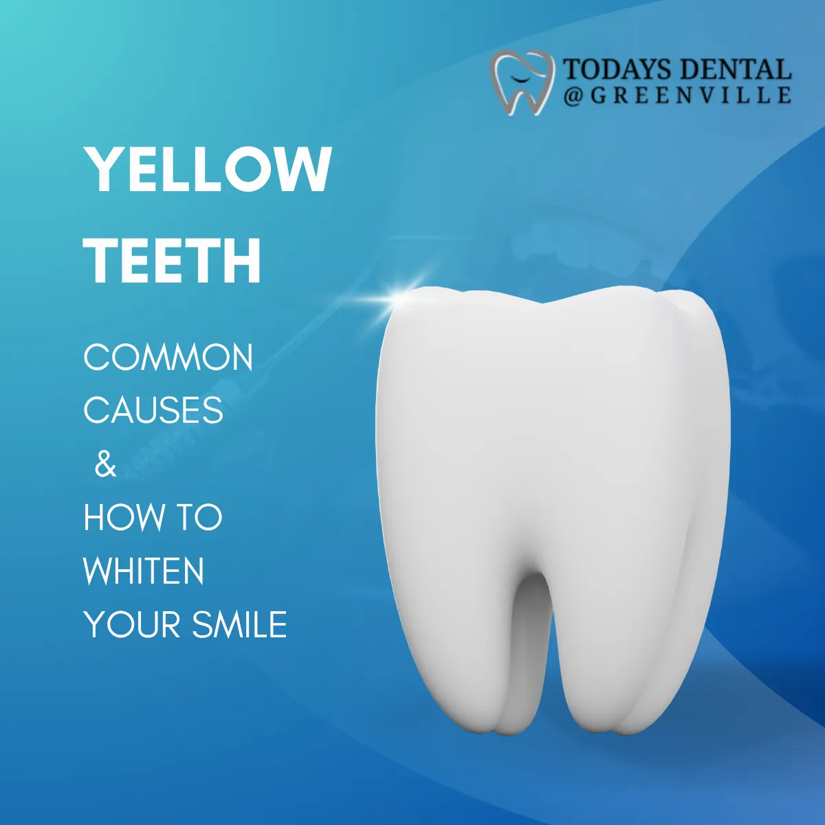 Yellow Teeth: Common Causes and How to Whiten Your Smile