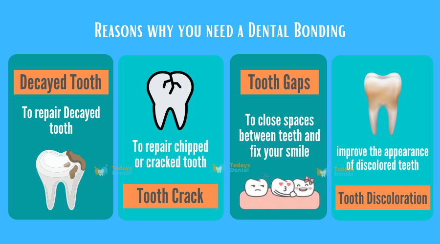 Todays Dental - Dental Bonding