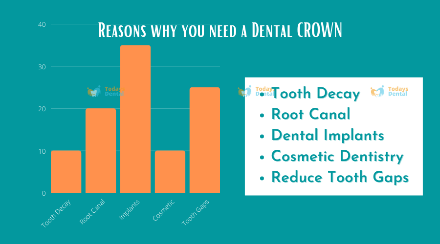 Todays Dental @ Greenville - Dental Crowns