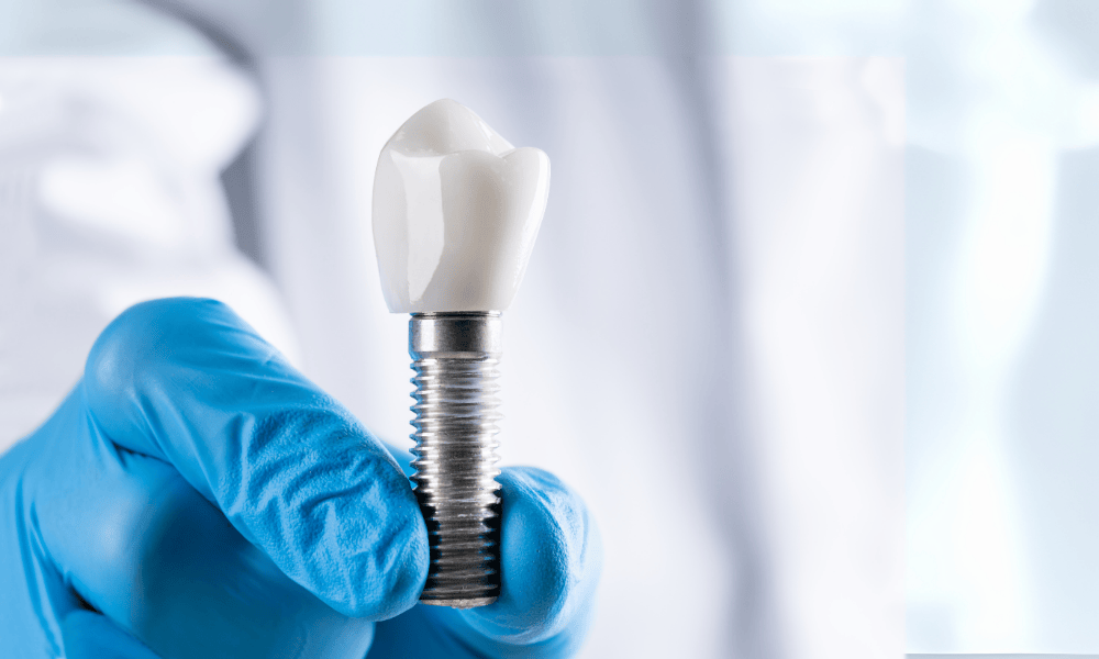 Why Choose Todays Dental Greenville for Dental Implants?